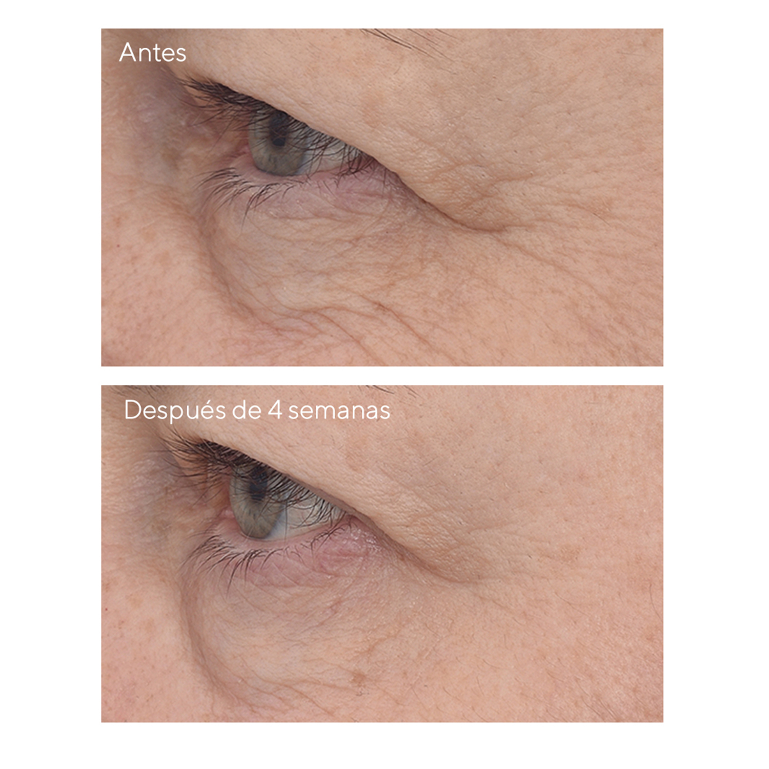 RETINAL RESCULPT EYE TREATMENT (TRATAMIENTO ANTIEDAD PARA OJOS CON RETINAL)